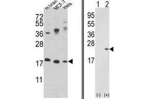 Image no. 1 for anti-Cofilin 1 (CFL1) (N-Term) antibody (ABIN452840) (Cofilin 抗体  (N-Term))