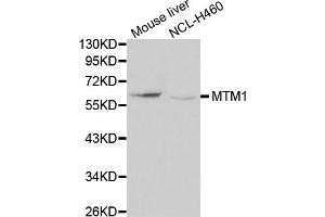 Western blot analysis of extracts of various cell lines, using MTM1 antibody (ABIN5970085) at 1/1000 dilution. (MTM1 抗体)