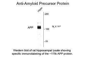 Western Blot of Anti-Beta Amyloid (Rabbit) Antibody - 612-401-253 Western Blot of Rabbit Anti-Beta Amyloid antibody. (beta Amyloid 抗体  (C-Term))