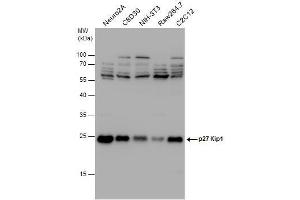 WB Image p27 Kip1 antibody detects p27 Kip1 protein by western blot analysis. (CDKN1B 抗体)