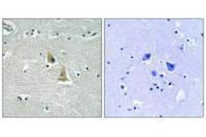 Immunohistochemistry analysis of paraffin-embedded human brain tissue using p47 phox (Ab-345) antibody. (NCF1 抗体  (Ser345))