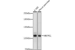 Western blot analysis of extracts of various cell lines, using MBTPS1 antibody (ABIN7268470) at 1:1000 dilution. (MBTPS1 抗体  (AA 803-1052))