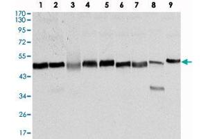 Western blot analysis using FOXD3 monoclonal antibody, clone 5G9  against NTERA-2 (1) , HUVE-12 (2) , HEK293 (3) , HeLa (4) , Jurkat (5) , K-562 (6) , RAW264.