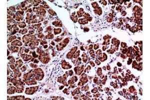 Immunohistochemistry (IHC) image for anti-Amphiphysin (AMPH) (C-Term) antibody (ABIN3187832)