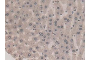 Detection of F2 in Rat Liver Tissue using Monoclonal Antibody to Coagulation Factor II (F2) (Prothrombin 抗体  (AA 44-200))