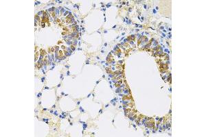 Immunohistochemistry of paraffin-embedded mouse lung using CEACAM5 antibody. (CEACAM5 抗体)