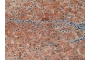 Immunohistochemistry (IHC) image for anti-Complement Component 1, Q Subcomponent, A Chain (C1QA) (AA 28-245) antibody (ABIN7435415)