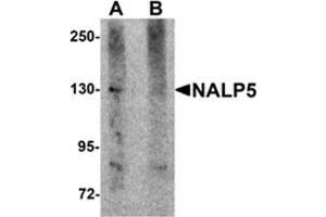 Western blot analysis of NALP5 in mouse brain tissue lysate with NALP5 antibody at 1 μg/ml in (A) the absence and (B) the presence of blocking peptide.