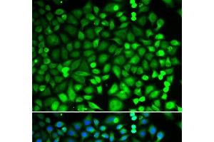 Immunofluorescence (IF) image for anti-Proteasome (Prosome, Macropain) Subunit, beta Type 2 (PSMB2) antibody (ABIN7257244)