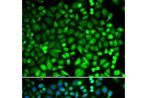 Immunofluorescence analysis of MCF-7 cells using PSMB2 Polyclonal Antibody (PSMB2 抗体)