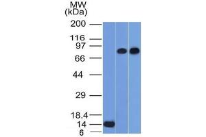 Western Blot of Recombinant, PC3 and HeLa cell lysates using p63 Mouse Monoclonal Antibody (TP63/1786). (p63 抗体  (AA 3-106))