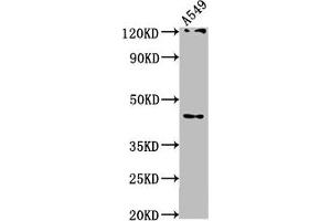 Western Blot Positive WB detected in: A549 whole cell lysate All lanes: AIFM2 antibody at 1:1000 Secondary Goat polyclonal to rabbit IgG at 1/50000 dilution Predicted band size: 41, 37 kDa Observed band size: 41 kDa (AIFM2 抗体  (AA 110-373))