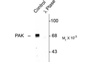 Image no. 1 for anti-P21-Activated Kinases 1/2/3 (PAK1/2/3) (pThr423) antibody (ABIN472196) (PAK1/2/3 抗体  (pThr423))