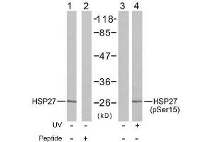 Image no. 2 for anti-Heat Shock 27kDa Protein 1 (HSPB1) (pSer15) antibody (ABIN196894) (HSP27 抗体  (pSer15))