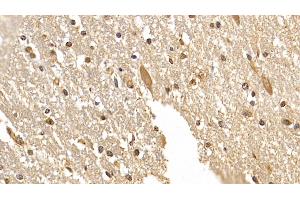 Detection of DCLK1 in Human Cerebrum Tissue using Monoclonal Antibody to Doublecortin Like Kinase 1 (DCLK1) (DCLK1 抗体  (AA 390-647))