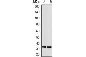 Western blot analysis of SGTA expression in A549 (A), U251 (B) whole cell lysates. (SGTA 抗体)