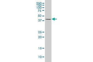 DDO polyclonal antibody (A01). (DDO 抗体  (AA 270-369))