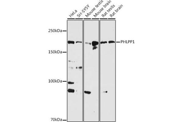 PHLPP1 抗体  (AA 1508-1717)
