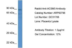 Western Blotting (WB) image for anti-Acyl-CoA Synthetase Medium-Chain Family Member 3 (ACSM3) (N-Term) antibody (ABIN786277) (ACSM3 抗体  (N-Term))
