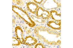 Immunohistochemistry of paraffin-embedded Human kidney using OLR1 antibody at dilution of 1:100 (x400 lens). (OLR1 抗体  (AA 58-273))