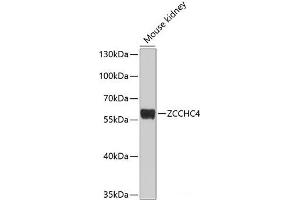 Western blot analysis of extracts of Mouse kidney using ZCCHC4 Polyclonal Antibody at dilution of 1:1000. (ZCCHC4 抗体)