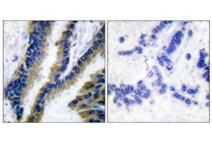 Immunohistochemistry (IHC) image for anti-Vav 1 Oncogene (VAV1) (Tyr174) antibody (ABIN1848166) (VAV1 抗体  (Tyr174))