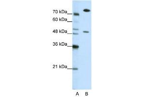 WB Suggested Anti-SSB Antibody Titration: 0. (SSB 抗体  (N-Term))