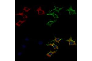 ABIN6258440 and ABIN6275234 staining 3 by IF/ICC. (MRPS22 抗体  (C-Term))
