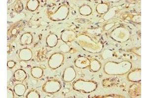 Immunohistochemistry of paraffin-embedded human kidney tissue using ABIN7145241 at dilution of 1:100 (BBS4 抗体  (AA 350-519))