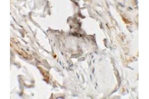 Immunohistochemistry of HHATL in human skin tissue with HHATL antibody at 2. (HHATL 抗体  (N-Term))