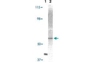 Western blot analysis using AKT2 monoclonal antibody, clone 1G8C12  against truncated AKT2 recombinant protein (Lane 1) and A-431 cell lysate (Lane 2). (AKT2 抗体)