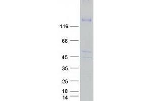 ATPase, Cu++ Transporting, beta Polypeptide (ATP7B) (Transcript Variant 1) protein (Myc-DYKDDDDK Tag)