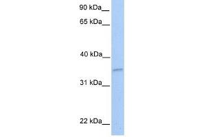 NKIRAS2 antibody used at 1 ug/ml to detect target protein. (NKIRAS2 抗体  (Middle Region))
