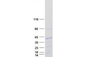 Western Blotting (WB) image for KIAA1191 (KIAA1191) (Transcript Variant 1) protein (Myc-DYKDDDDK Tag) (ABIN2724207)