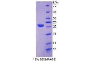 SDS-PAGE (SDS) image for Lipase A, Lysosomal Acid, Cholesterol Esterase (LIPA) (AA 32-201) protein (His tag) (ABIN2125684) (Lipase A Protein (AA 32-201) (His tag))