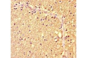 Immunohistochemistry of paraffin-embedded human brain tissue using ABIN7175986 at dilution of 1:100 (ZBTB46 抗体  (AA 174-362))