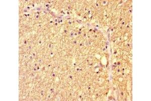 Immunohistochemistry of paraffin-embedded human brain tissue using ABIN7175986 at dilution of 1:100 (ZBTB46 抗体  (AA 174-362))