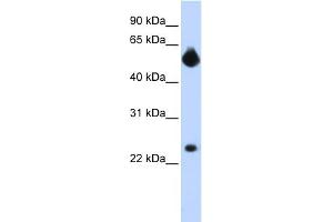WB Suggested Anti-NOTCH4 Antibody Titration:  0. (NOTCH4 抗体  (Middle Region))