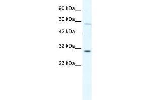Human K562; WB Suggested Anti-GATAD1 Antibody Titration: 0. (GATAD1 抗体  (C-Term))
