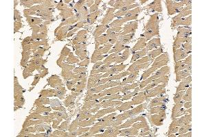 ABIN7094925 and ABIN7098981 at 1/100 staining rat heart tissue by IHC-P.