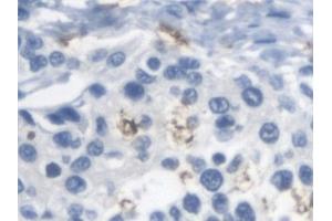 Immunohistochemistry (IHC) image for anti-Arylsulfatase A (ARSA) antibody (ABIN7441370)