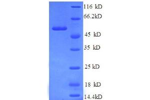 SDS-PAGE (SDS) image for Replication Protein A2, 32kDa (RPA2) (AA 1-267), (partial) protein (GST tag) (ABIN7479332)