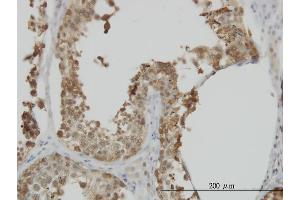 Immunoperoxidase of monoclonal antibody to HSPA1L on formalin-fixed paraffin-embedded human testis. (HSPA1L 抗体  (AA 561-641))