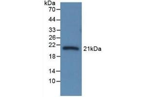 Detection of Recombinant CBG, Rat using Monoclonal Antibody to Corticosteroid Binding Globulin (CBG) (SERPINA6 抗体  (AA 173-344))