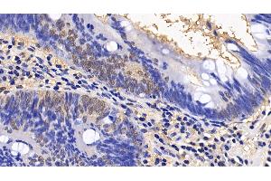 Immunohistochemistry (IHC) image for anti-Eukaryotic Translation Initiation Factor 4E Binding Protein 1 (EIF4EBP1) (AA 2-118) antibody (ABIN7436819)