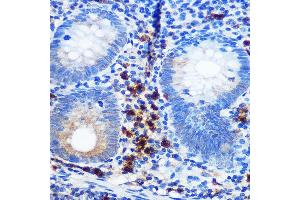 Immunohistochemistry of paraffin-embedded human appendix using CD41/ITGB Rabbit mAb (ABIN7267925) at dilution of 1:100 (40x lens). (Integrin Alpha2b 抗体)