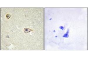 Immunohistochemistry (IHC) image for anti-Cytochrome P450, Family 19, Subfamily A, Polypeptide 1 (CYP19A1) (AA 221-270) antibody (ABIN2889935) (Aromatase 抗体  (AA 221-270))