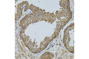 Immunohistochemistry of paraffin-embedded human prostate using CHRFA antibody (ABIN6131933, ABIN6138559, ABIN6138561 and ABIN6223818) at dilution of 1:100 (40x lens). (CHRFAM7A 抗体  (AA 1-150))
