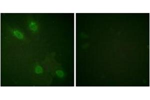 Immunofluorescence (IF) image for anti-Mediator Complex Subunit 1 (MED1) (AA 1423-1472) antibody (ABIN2888695) (MED1 抗体  (AA 1423-1472))