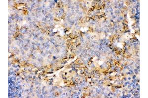 IHC analysis of CD134 using anti-CD134 antibody (ABIN3044553).